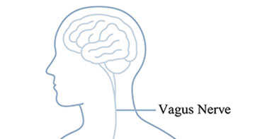 Rewiring Stroke Recovery with Vagus Nerve Stimulation