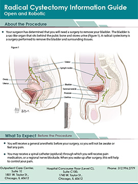 Radical Cystectomy Information Guide