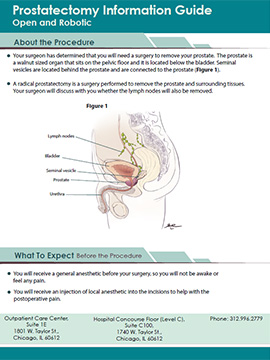 Prostatectomy Information Guide