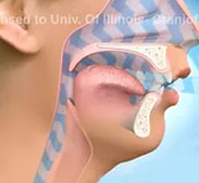 Airway