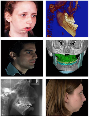 Images of Jaw Surgeries we treat