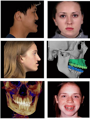 more images of jaw surgeries we treat