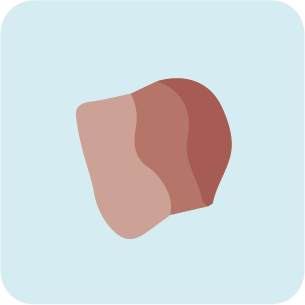 Illustration of a skin lesion
