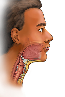 TEP Diagram