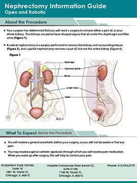 Nephrectomy Info Guide Cover