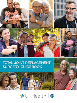 Joint Replacement Surgery Guidebook